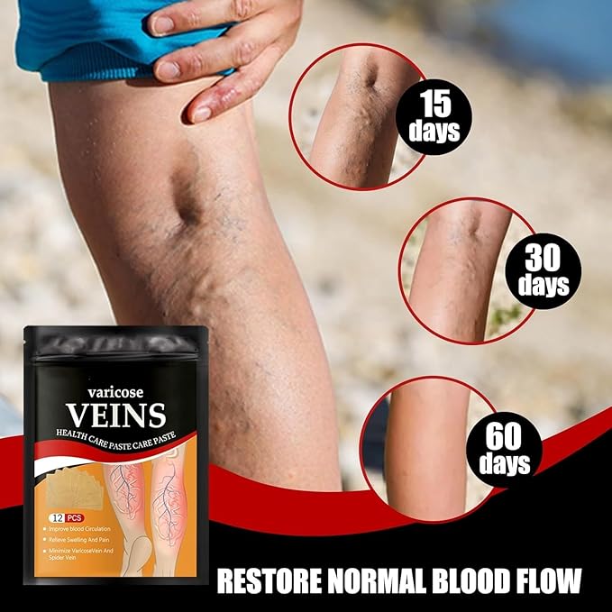 Varicose Veins Patches